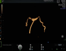 1711018689209520.png image.png